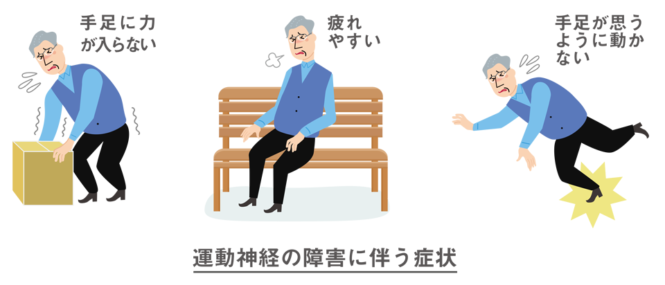 イラスト：運動神経の障害に伴う症状